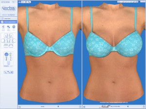 VECTRA 3D Cosmetic Imaging Dallas Richardson TX