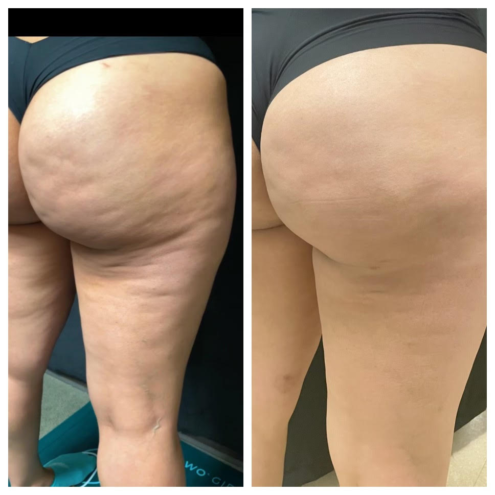 before/after