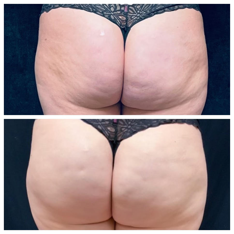 before/after